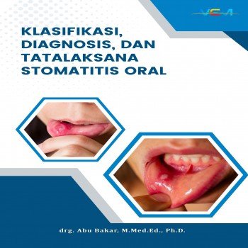 KLASIFIKASI DIAGNOSIS DAN TATA LAKSANA STOMATITIS ORAL